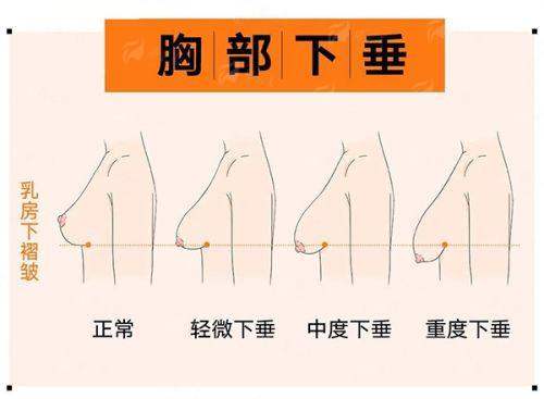 三、广东韩妃整形外科医院真实实例见证技术成效