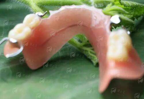 五、广东韩妃整形外科医院陈秋怡医生术后服务