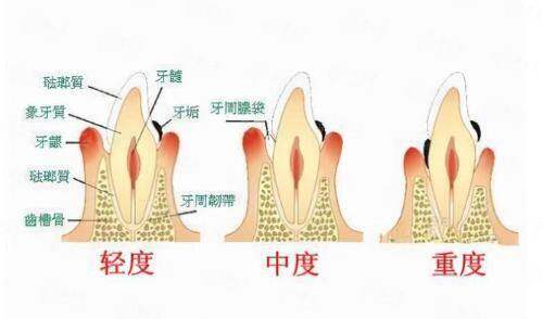 广东韩妃张金明和梁晓姻双眼皮价格对比看，性价比无敌！赶紧预约挂号