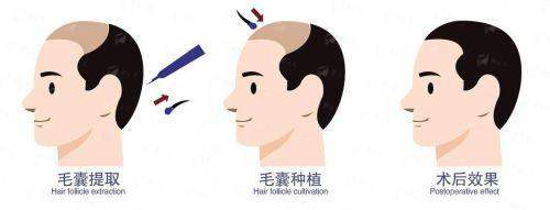 广东韩妃梁晓姻医生技术手法怎么样？与其他医生对比看，到院地址和预约方式都在这！