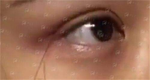 五、李宗磊医生技术特色解析