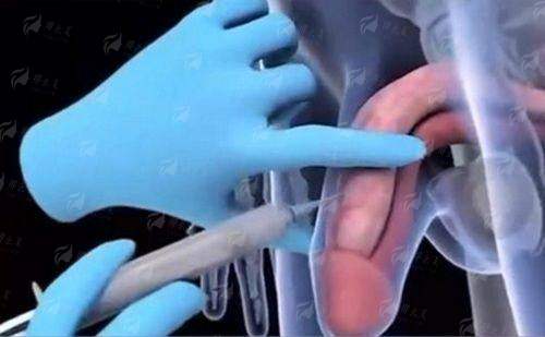 四、广东韩妃整形外科医院特色项目价格参考