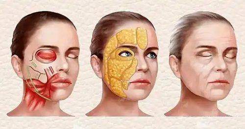 三、广东韩妃整形外科医院真实实例见证