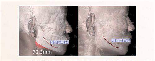 五、广东韩妃整形外科医院术后管理体系