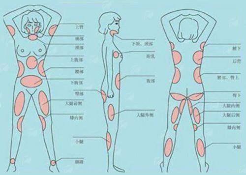 二、广东韩妃整形外科医院轮廓整形的项目优势