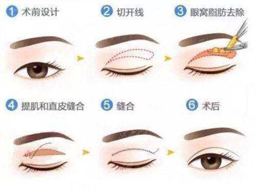 广东韩妃李宗磊医生技术手法怎么样？全解析在此，别错过预约挂号机会！