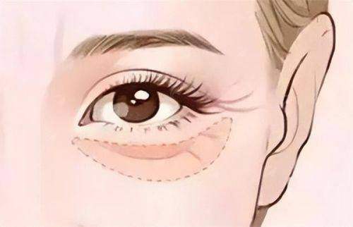 四、真实实例分享