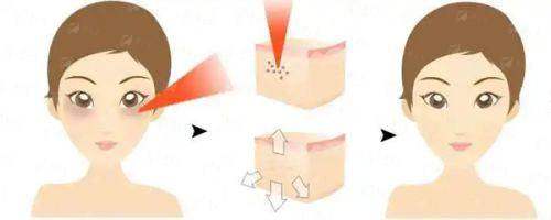 二、广东韩妃整形外科医院陈秋怡医生擅长项目