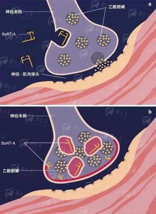 四、广东韩妃整形外科医院黄伦武医生的手术特色