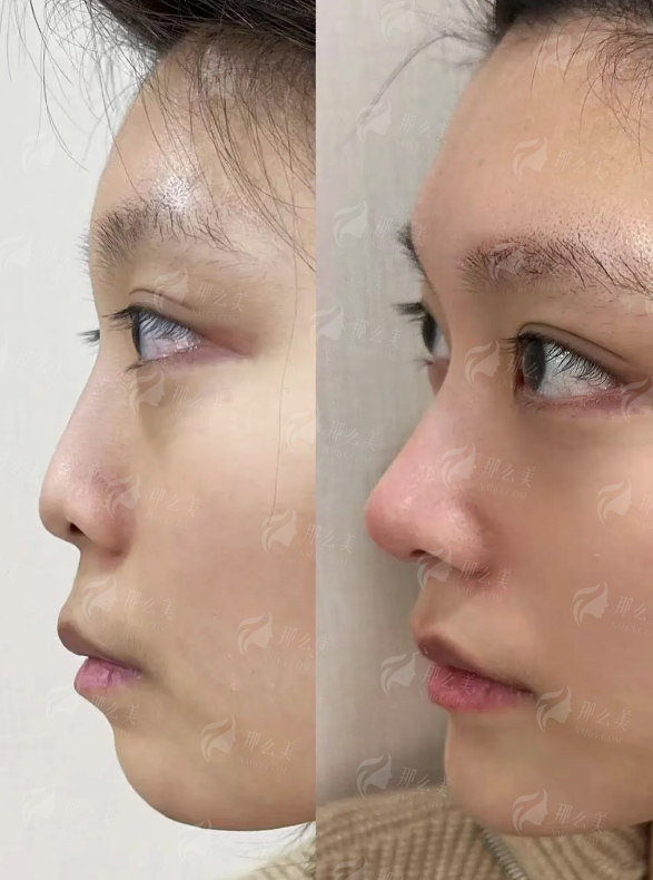 二、张金明医生:自然派双眼皮塑造骨干医生