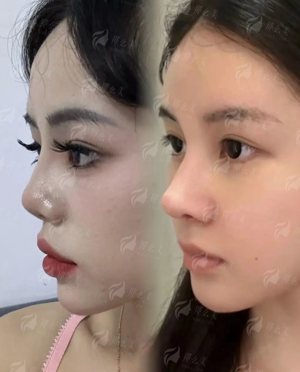 二、徐州芊华医疗美容做的咋样？技术口碑大起底