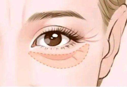 三、郑州蕾娜斯祛眼袋医生怎么选？坐诊信息一览