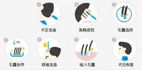 一、福州海峡美容医院植发成效怎么样？