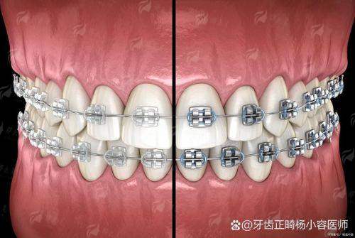 淮南牙齿矫正好医院哪家强？新华医疗VS安美口腔真实对比测评