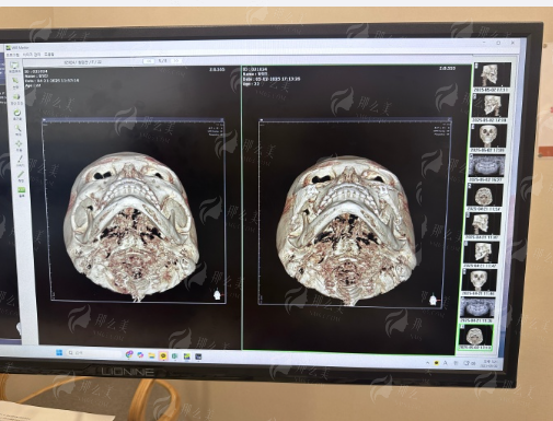 六安整形机构哪家强？菲凡、美南华、智颜星范三家对比看，真实案例全公开！