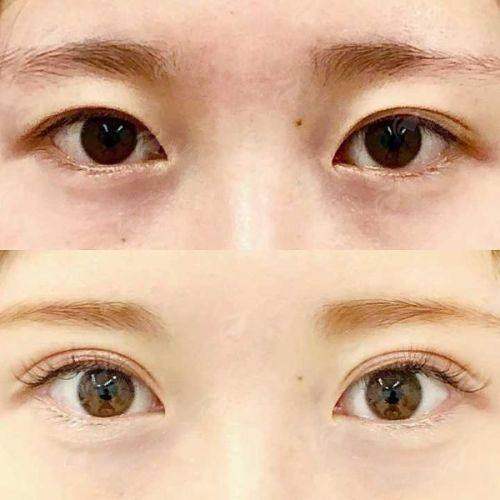 四、青岛诺德马昕眼修复怎么预约？