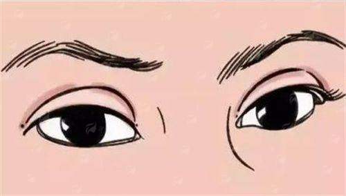 四、怎么预约长沙雅美的全切双眼皮？