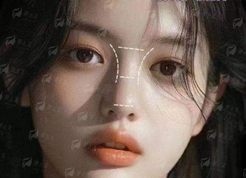 二、广州高尚黄金龙隆鼻的价格贵不贵？