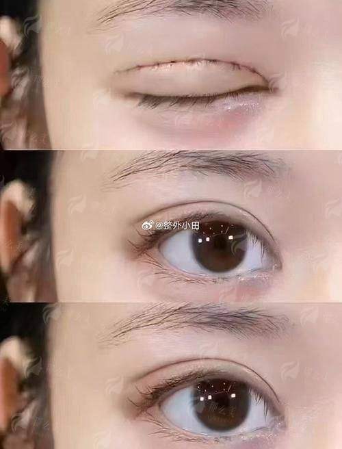 三、青岛诺德马昕眼修复价格贵吗？