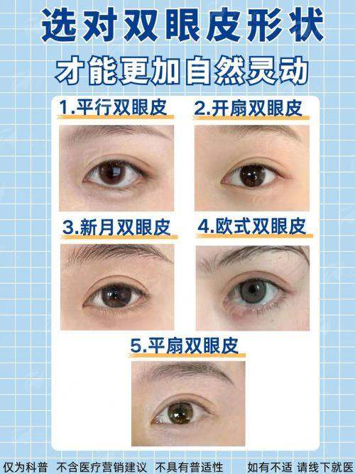 四、鲁华双眼皮怎么预约?河南郑州整形美容避坑指南