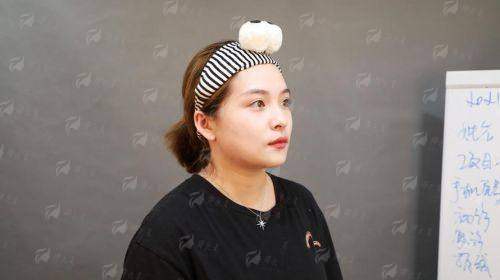 一、长沙星雅罗盛军做鼻综合技术强在哪？