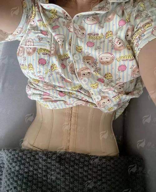 一、深圳安美聚光彭喜吸脂靠不靠谱？先看院长硬实力