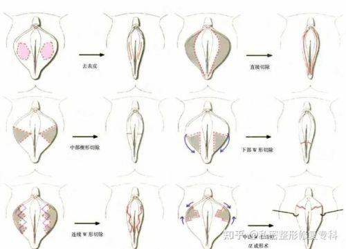 三、深圳私密护理价格大对比（港龙vs其他机构）