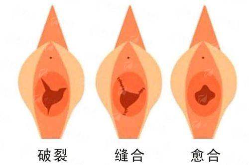 二、北京新星靓阴道紧缩价格贵吗？