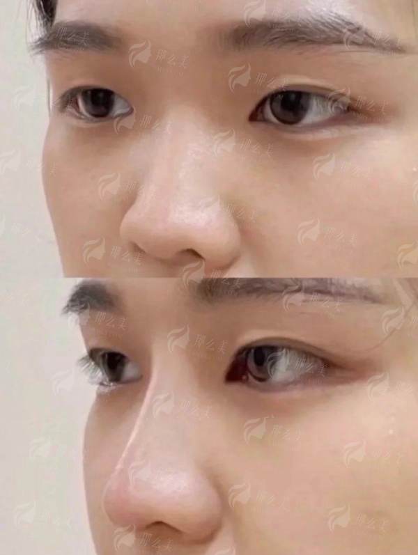 四、长沙星雅整形预约指南