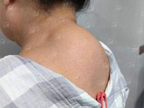 四、苏州铂蔓医疗富贵包整形预约指南