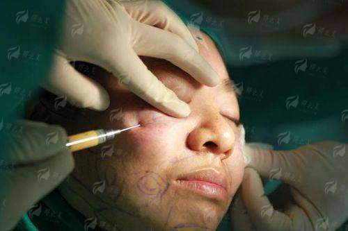 四、郑州缔莱美面部吸脂值得选择吗？