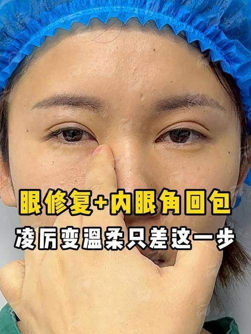 重庆长良医疗美容刘晓伟做眼修复好不好？医生技术全解析，附医院详细介绍！