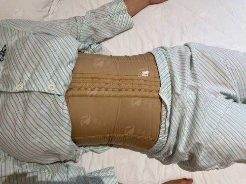 三、淮安唯尔美腰腹吸脂术后要注意什么？