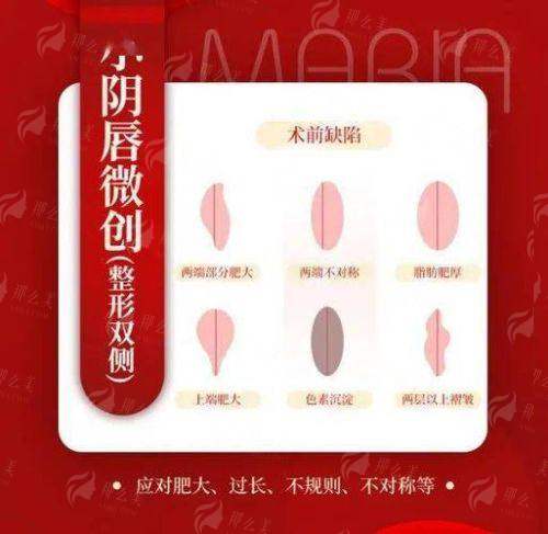 三、哪些人适合在杭州红房子医院做3D生物束带?医生这样建议