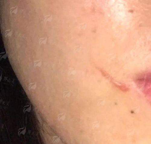 三、胥肖琴医生做的好吗?价格与预期管理