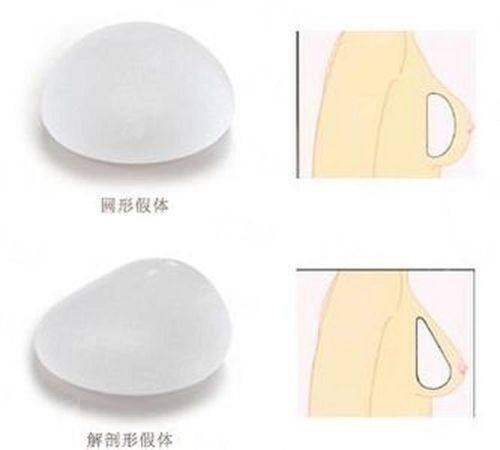 三、武汉艺星隆胸假体选择指南