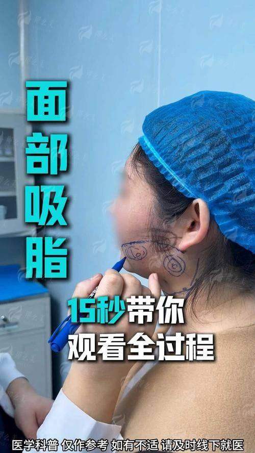 三、成都纯曦医院环境和预约要注意什么？