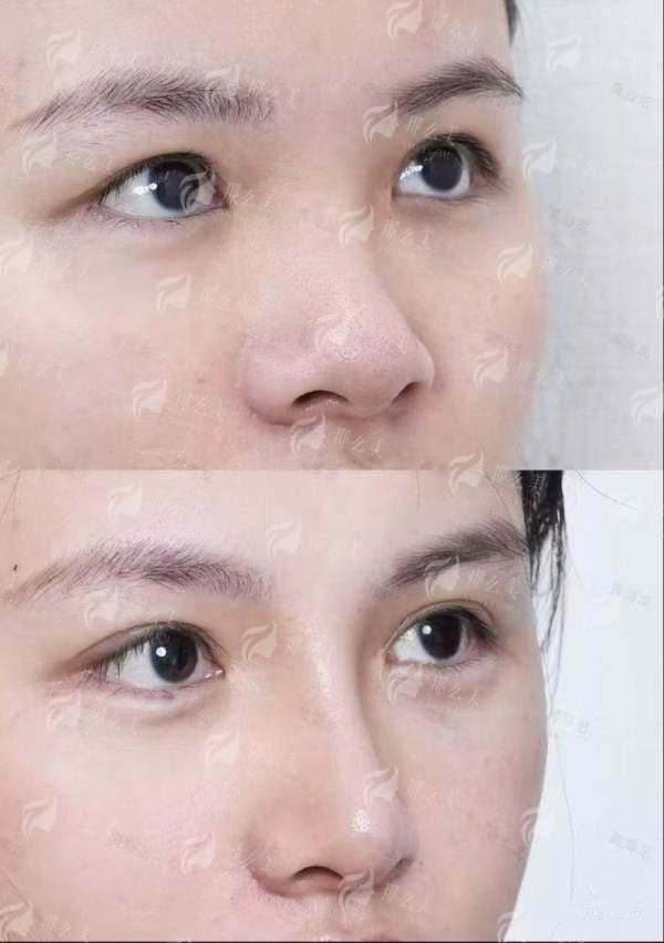 三、台州温岭韩辰医疗美容的真实口碑大调查