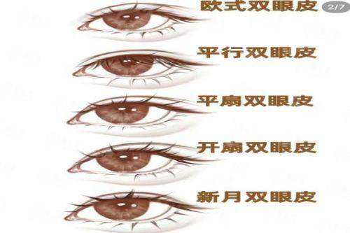 银川时光相伴医疗美容双眼皮手术选谁？黄娟和付聪医生技术、风格、恢复期全解析