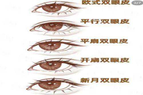 二、银川时光相伴医疗美容付聪医生：精致放大眼骨干医生