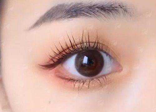 六、选择正规机构的必要性