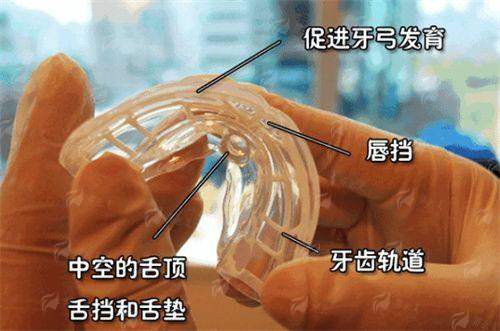 三、南昌贝尔口腔牙齿矫正真实实例成效怎么样？