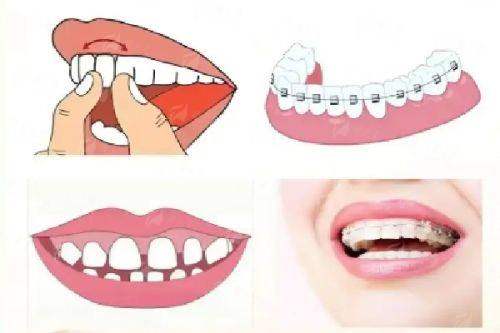 二、南昌贝尔口腔牙齿矫正有哪些特色技术？