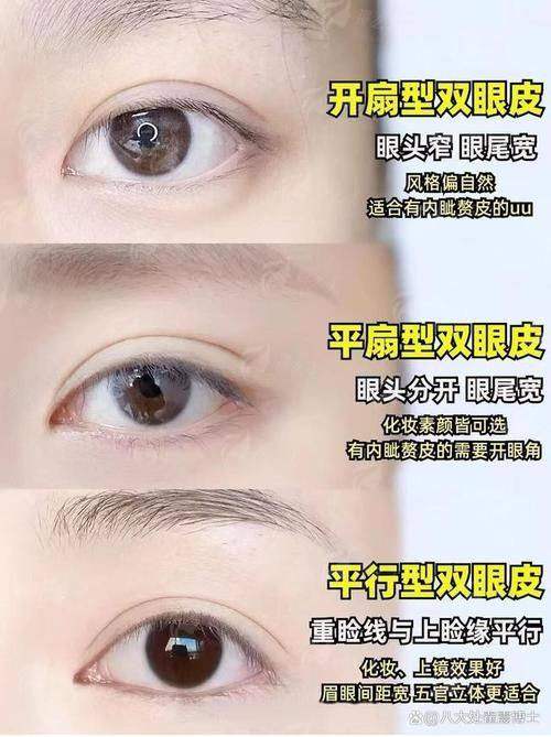 二、云南悦之美做双眼皮有哪些避坑必问项？