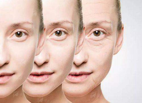 三、哈尔滨爱琪医美眼周黑绷带成效能维持多久？