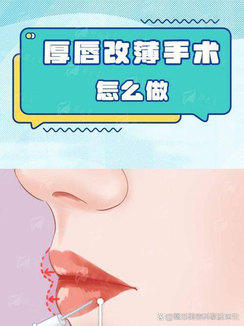 四、如何预约西宁青美余红敏医生的微笑唇?