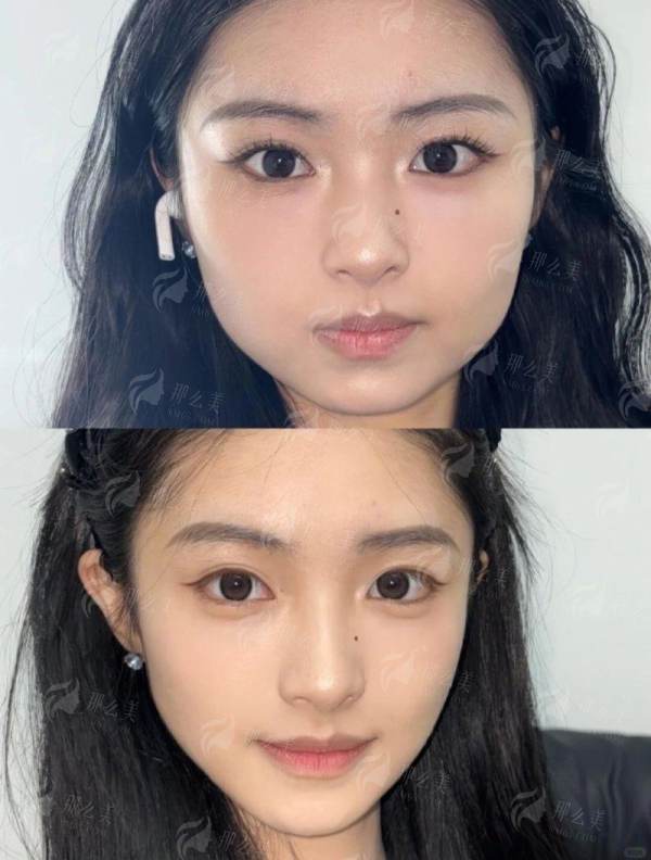 馒化修复必看！宁波拾壹逐光医疗美容修复技术详解，附医院地址&医生介绍