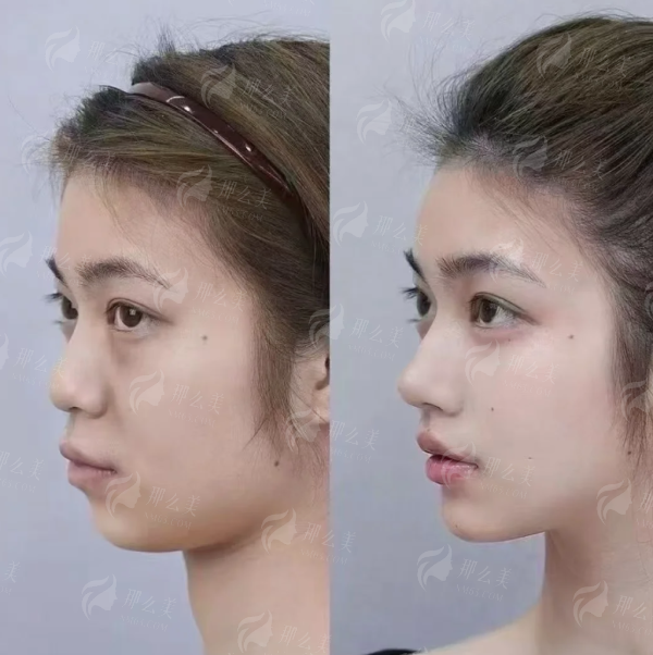 四、怎么预约宁波拾壹逐光医疗美容的馒化修复？