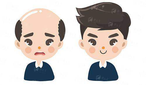 四、淮安艺后陈男男植发怎么预约？全新攻略来了