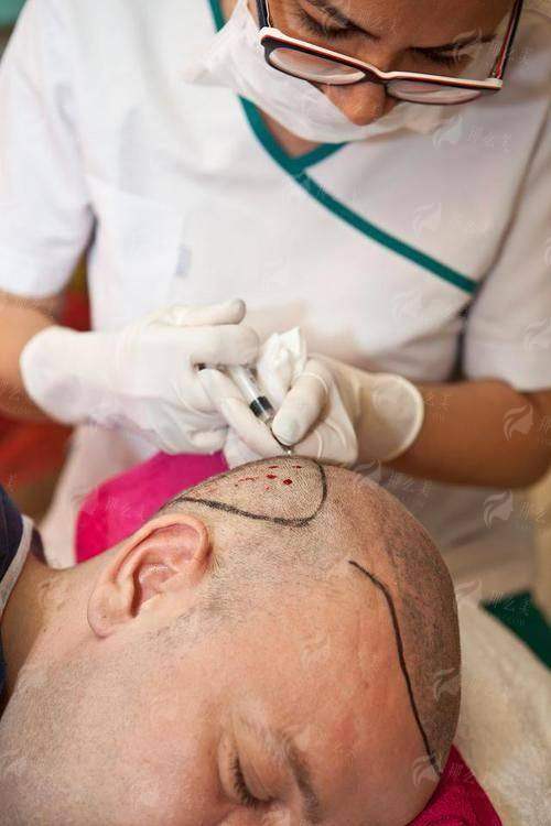 三、淮安艺后陈男男植发价格贵不贵？同城对比表